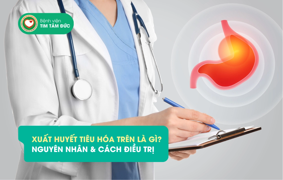 XUẤT HUYẾT TIÊU HÓA TRÊN