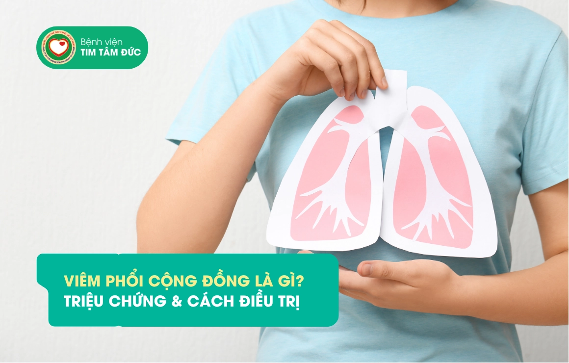 VIÊM PHỔI CỘNG ĐỒNG