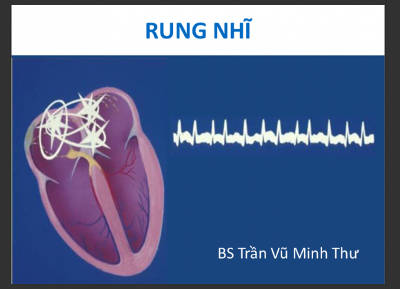 ECG rung nhĩ 2018