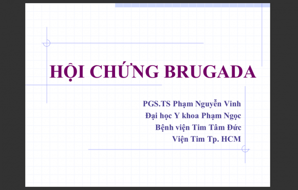 Hội chứng Brugada