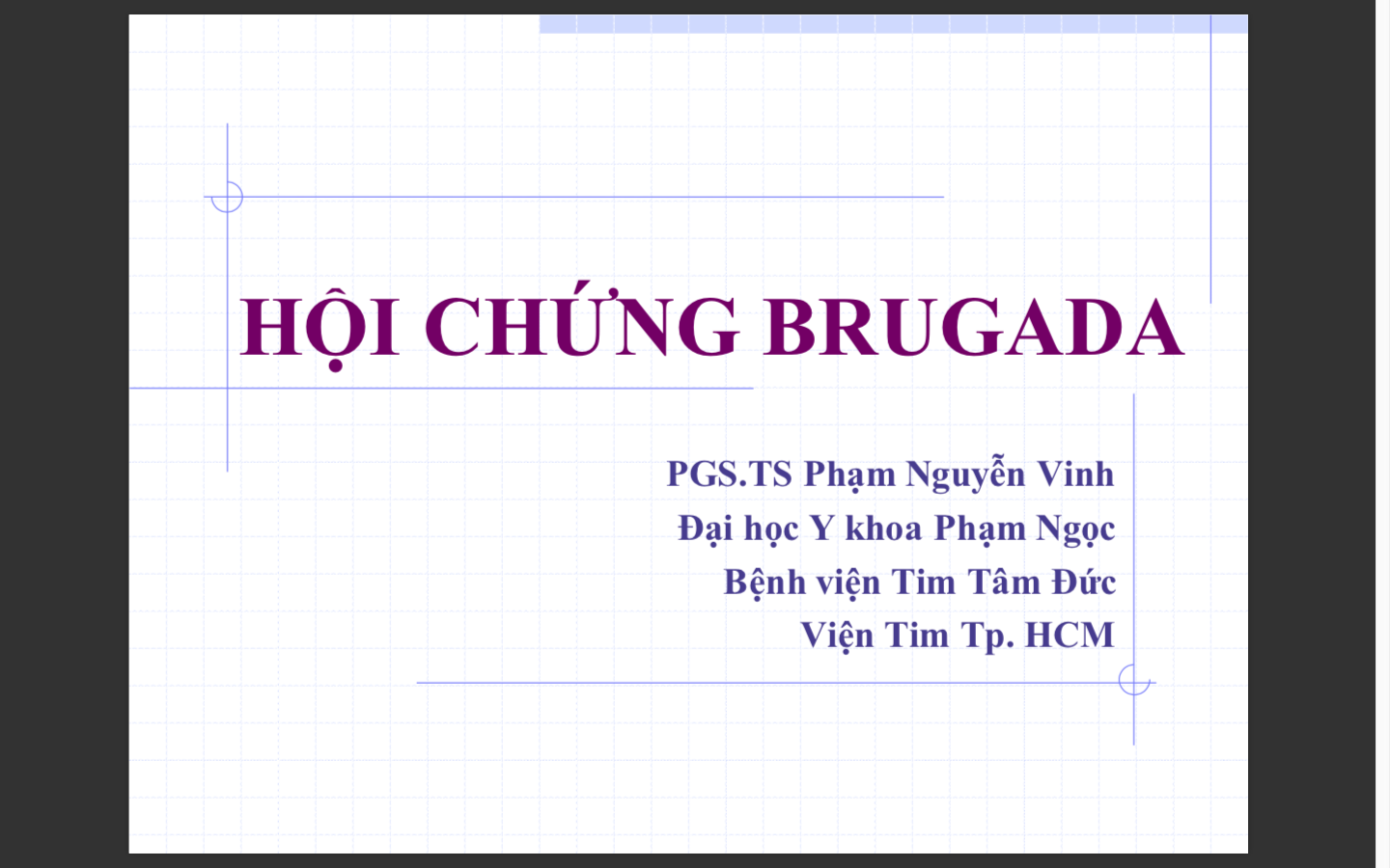 Hội chứng Brugada