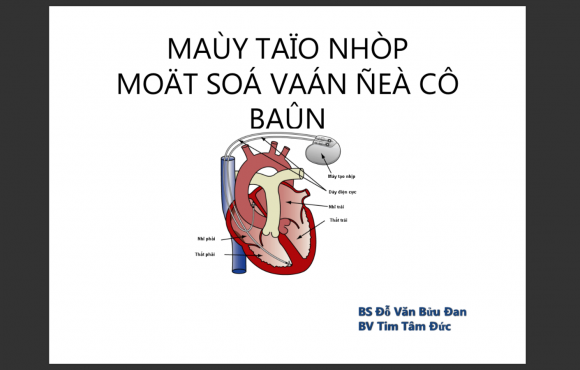 Máy tạo nhịp 2016