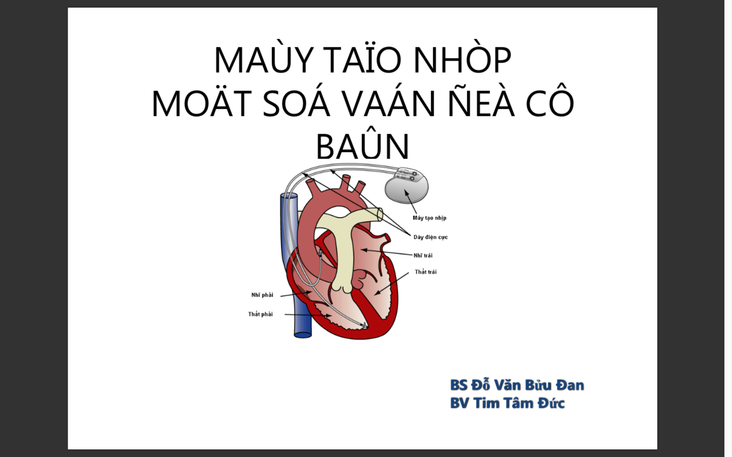 Máy tạo nhịp 2016
