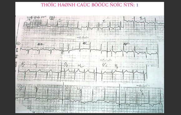 Thực hành các bước đọc DTD