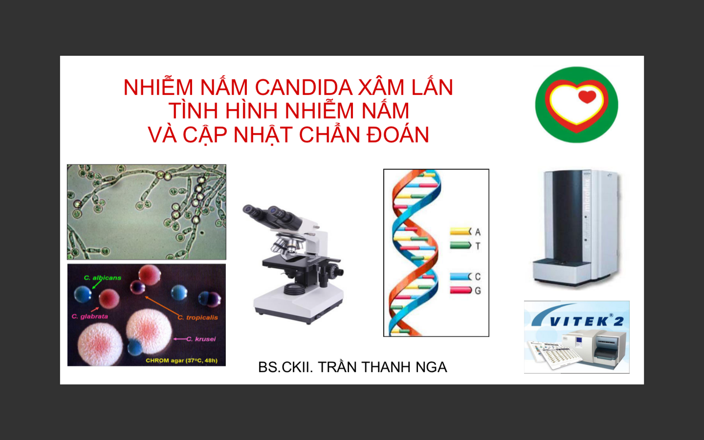 Nhiễm nấm xâm lấn