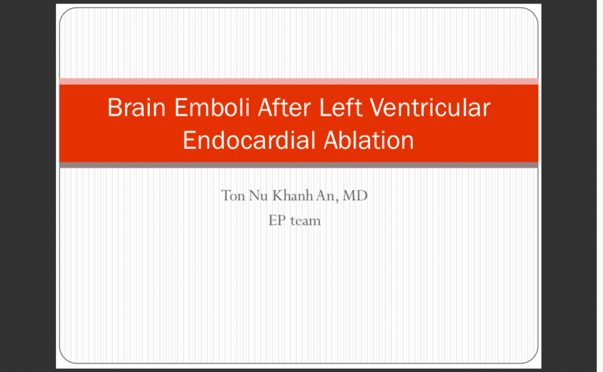 Brain Emboli After Left Ventricular Endocardial Ablation