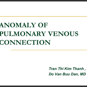 Anomaly of pulmonary venous connection