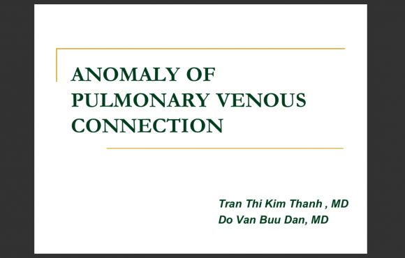 Anomaly of pulmonary venous connection