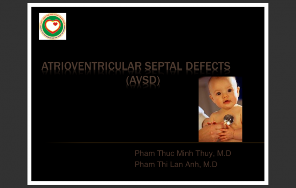 Atrioventricular septal defects