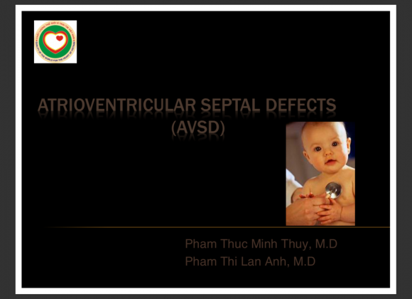 Atrioventricular septal defects