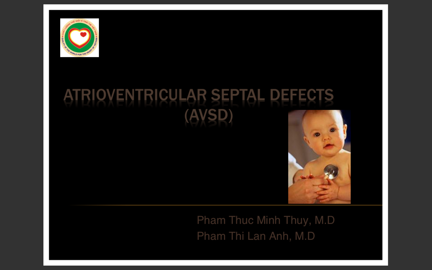 Atrioventricular septal defects