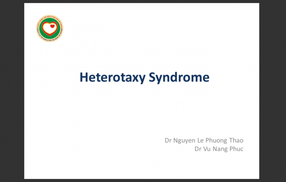 Heterotaxy Syndrome