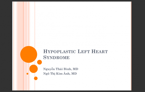 Hypoplastic Left Heart Syndrome