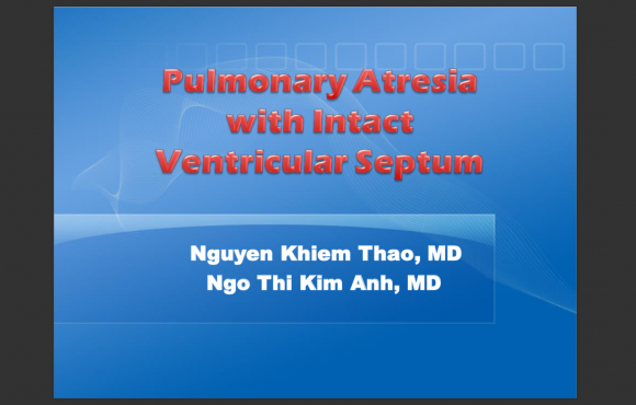 Pulmonary Atresia with Intact Ventricular Septum