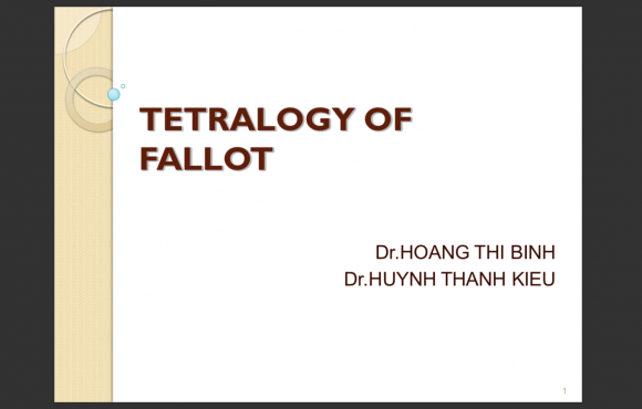 Tetralogy of fallot