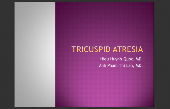Tricuspid Atresia