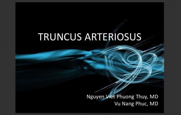 Truncus arteriosus