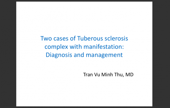 Two cases of Tuberous sclerosis complex with manifestation: Diagnosis and management