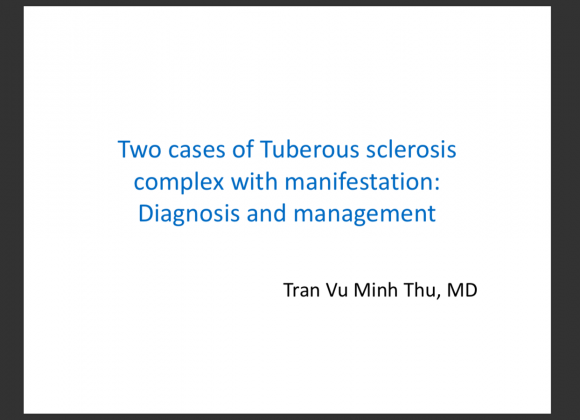 Two cases of Tuberous sclerosis complex with manifestation: Diagnosis and management