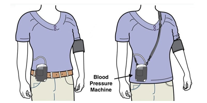 Ai nên sử dụng máy đo huyết áp holter?
