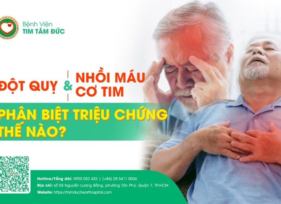 Nhồi máu cơ tim và đột quỵ