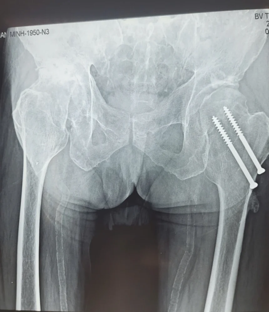 casestudy-2025-0203-NTM3-benhnhanTranTuanMinh