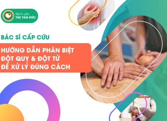 bác sĩ hướng dẫn phân biệt đột tử và đột quỵ