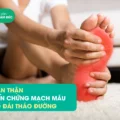 biến chứng đái tháo đường