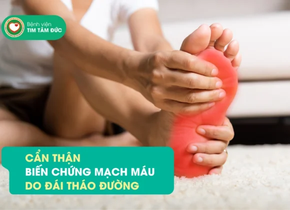biến chứng đái tháo đường