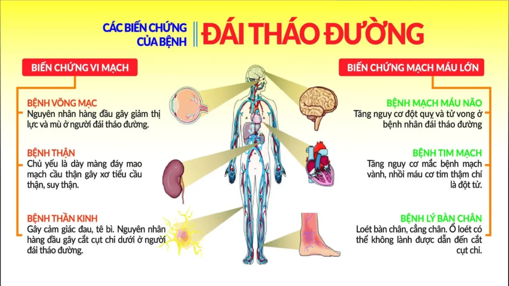 biến chứng đái tháo đường
