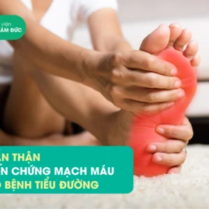 bien-chung-mach-mau-do-benh-tieu-duong-7 biến chứng đái tháo đường