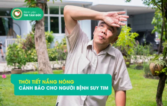 nắng nóng